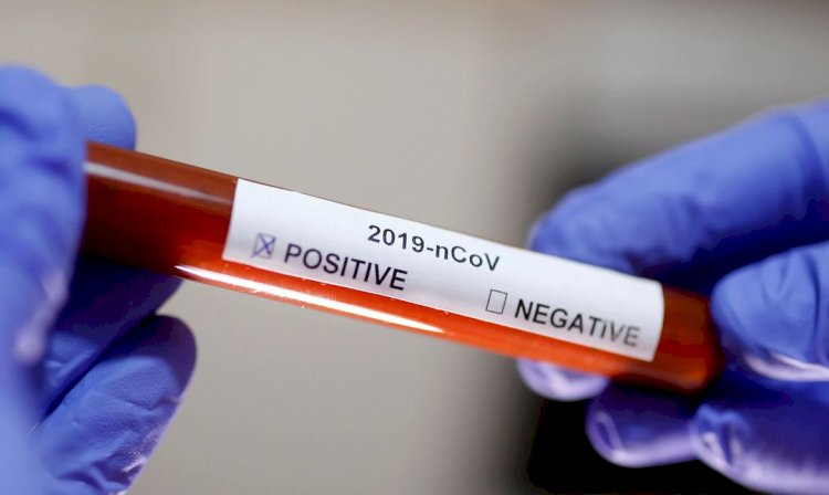 Goiás confirma 20.783 mortes e 742.606 casos da doença